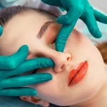 هزینه عمل زیبایی بینی در رشت