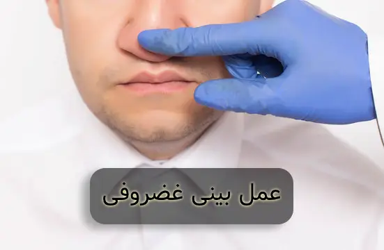 جراحی بینی غضروفی