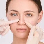 جراحی کوچک کردن پره های بینی