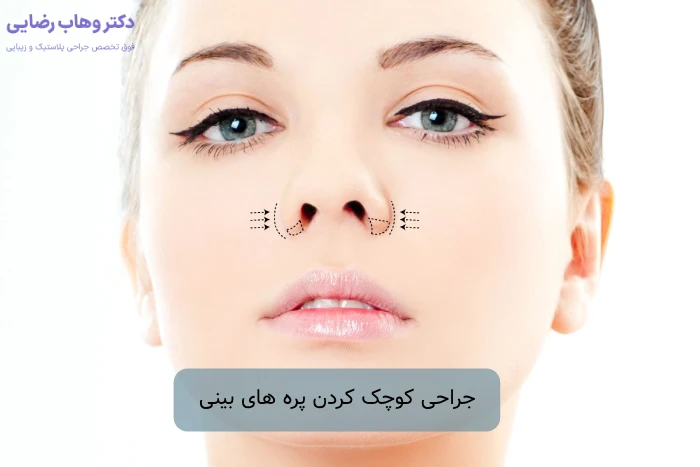 جراحی کوچک کردن پره های بینی