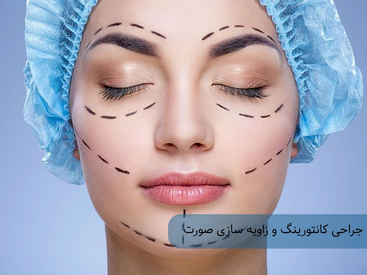 جراحی کانتورینگ صورت