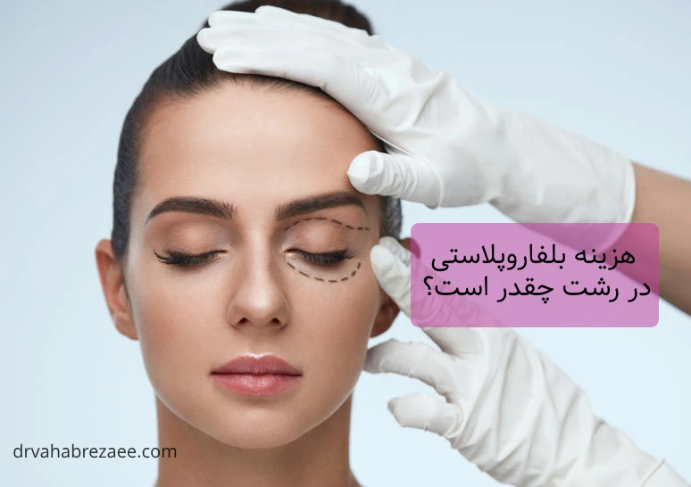 هزینه عمل افتادگی پلک در رشت