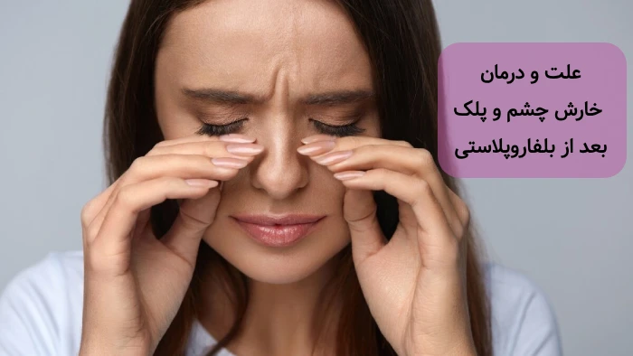 علت و درمان خارش پلک بعد از بلفاروپلاستی