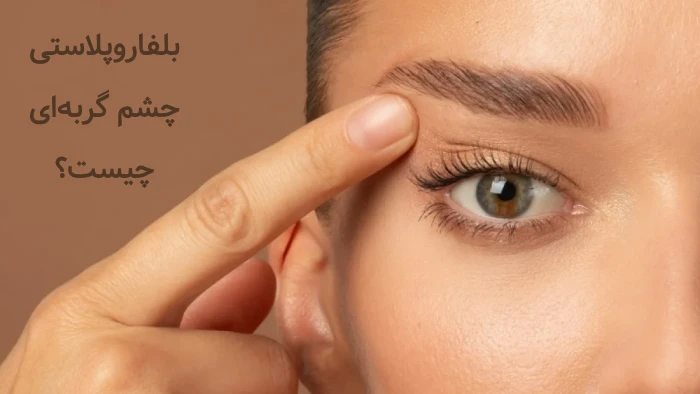 عمل بلفاروپلاستی چشم گربه ای