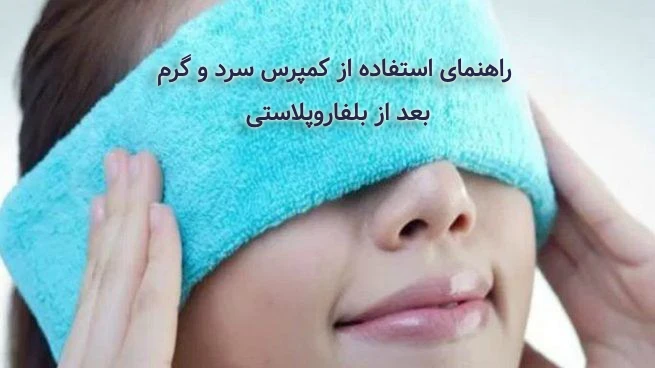 کمپرس سرد و گرم بعد از بلفاروپلاستی